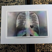 X-Ray Heart Art Print - Thumbnail 2